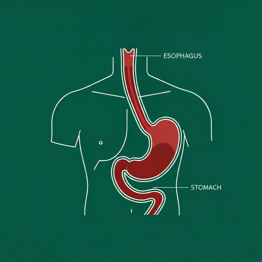 Why GERD Keeps Happening